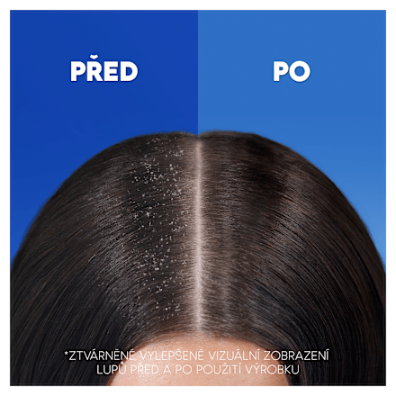 šampon na vlasy Anti Hair Fall s kofeinem head&shoulders