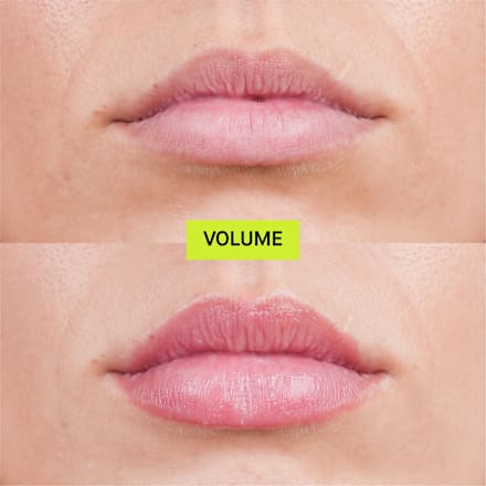 Balzam na zväčšenie pier Volume Hydro Plump Lip Augmentation Transparent Lab