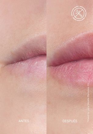 Lippenpflege Volume Hydrating Treatment Transparent Lab