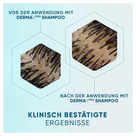 Shampoo Derma x Pro Beruhigende Pflege head&shoulders
