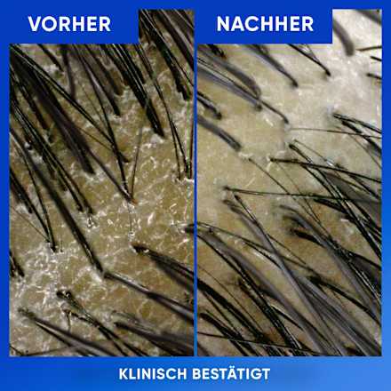 Anti-Schuppen Shampoo Reinigung & Glanz mit Apfelessig head&shoulders