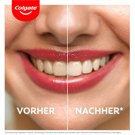 Zahnpasta Max White Ultra Active Foam Colgate