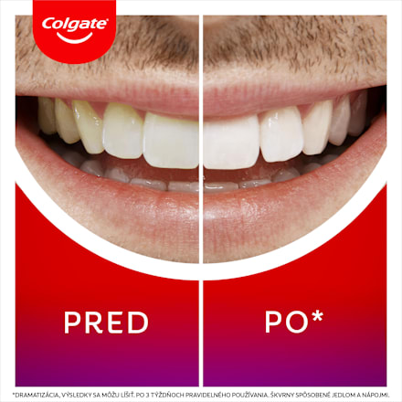 Bieliace pero Max White Overnight Colgate