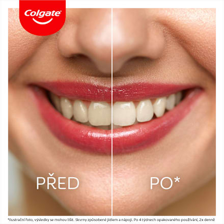 bělicí zubní pasta Max White Ultra Multiprotect Colgate