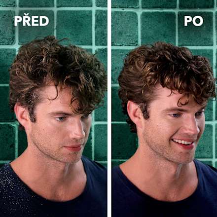 šampon proti lupům Anti-Dandruff Sensitive schauma