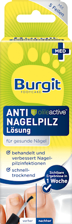 Nagelpilz Entferner Lösung Burgit