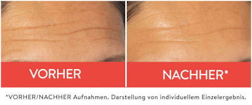 Serum Peptide+ Falten Filler Judith Williams
