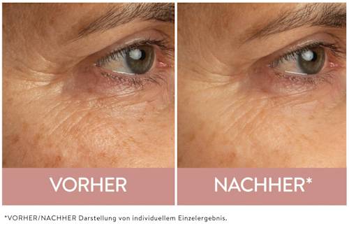 Augencreme Retinol Science Judith Williams