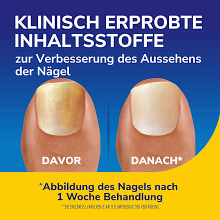 Nagel Revitalisierer Whitening Serum Dr. Scholl's