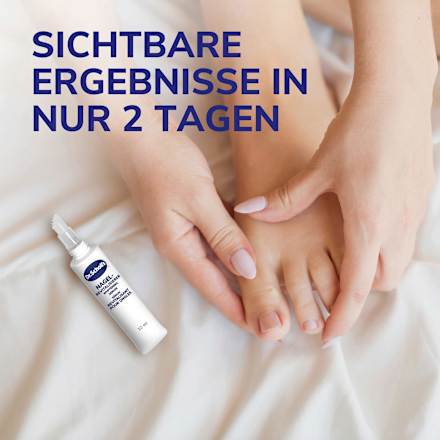 Nagel Revitalisierer Whitening Serum Dr. Scholl's