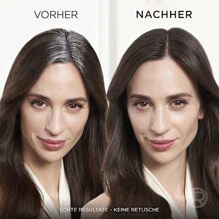 Ansatzspray Blond bis Mittelblond L'ORÉAL PARiS MAGIC RETOUCH
