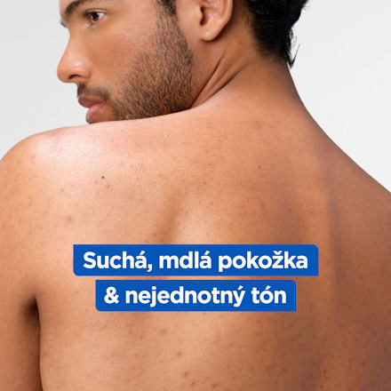tělové mléko Niacinamide Bright Mixa