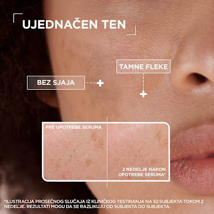 VITAMIN C + GLYCOLIC ACID serum za lice Mixa