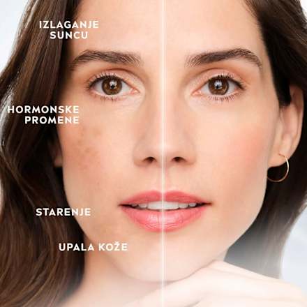 LUMINOUS 630 ANTISPOT DARK SPOT serum za lice NIVEA