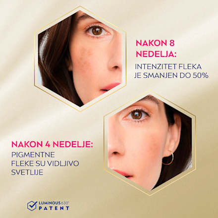 LUMINOUS 630 ANTISPOT DARK SPOT serum za lice NIVEA