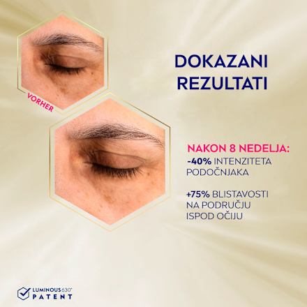 Cellular Luminous630 - krema protiv podočnjaka NIVEA