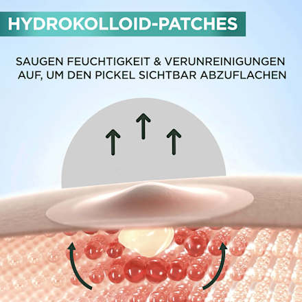 Anti Pickel Pimple Patches Hydrokolloid  Garnier Skin Active