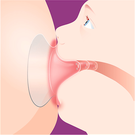 Chránič prsných bradaviek - S PHILIPS AVENT