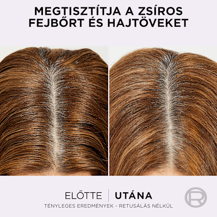 Balzsam Hyaluron Pure L'ORÉAL PARiS ELSEVE