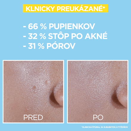 Denný pleťový UV fluid proti nedokonalostiam BHA + Niacinamide SPF 50+ GARNIER PureActive