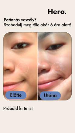 Mighty Patch Invisible+ pattanás elleni tapasz Hero.