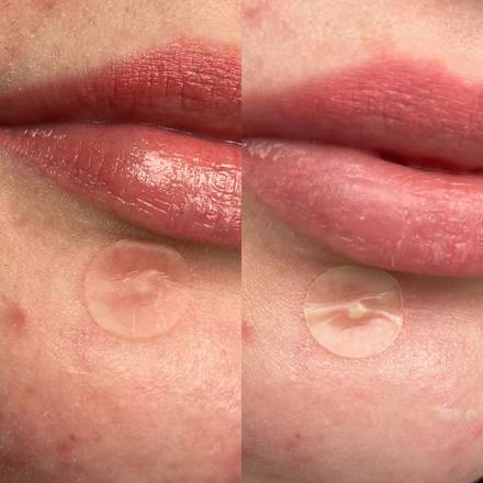 Mighty Patch Invisible+ pattanás elleni tapasz Hero.