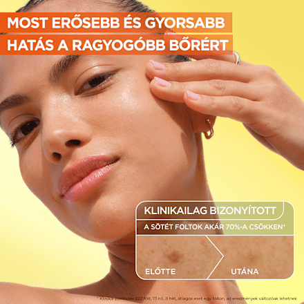 Arcápoló szérum C-vitaminnal + niacinamiddel + szalicilsavval GARNIER SKIN NATURALS