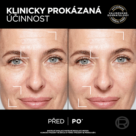 Age Perfect sérum Cell Renew L'ORÉAL PARiS AGE PERFECT