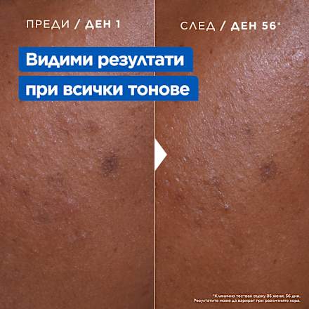 Крем за тяло Niacinamide Bright  Mixa