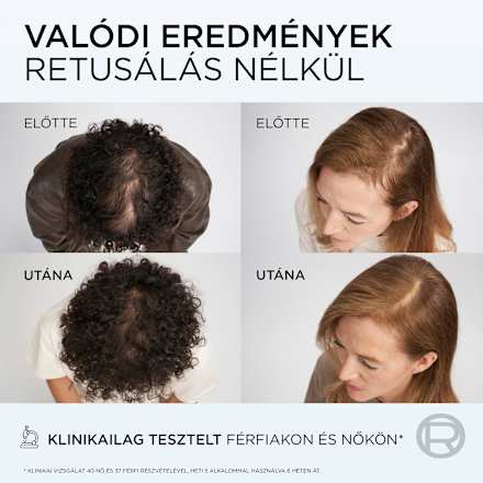 Sampon Growth Booster, hullásra és töredezésre hajlamos hajra L'ORÉAL PARiS ELSEVE