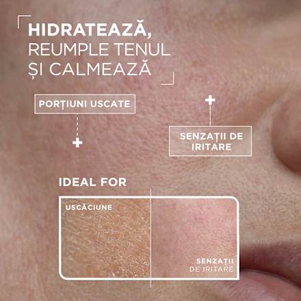 Serum anti uscăciune pentru tenul sensibil Mixa