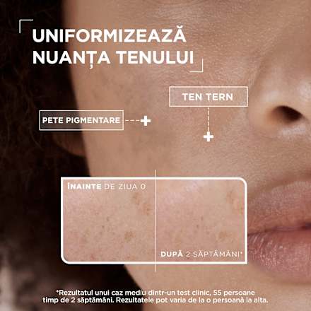 Serum anti pete pigmentare pentru tenul sensibil Mixa