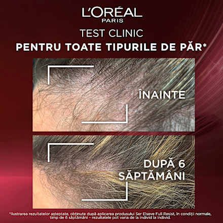 Ser pentru păr fragil cu tendință de cădere, Full Resist Aminexil L'ORÉAL PARiS ELSEVE