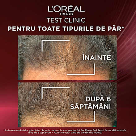 Ser pentru păr fragil cu tendință de cădere, Full Resist Aminexil L'ORÉAL PARiS ELSEVE