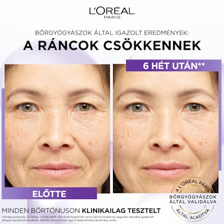 Revitalift filler szérum, hyaluronnal L'ORÉAL PARiS REVITALIFT