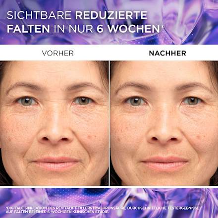 Anti Falten Serum Revitalift Filler 1,5 % Pure Hyaluronsäure L'ORÉAL PARiS REVITALIFT