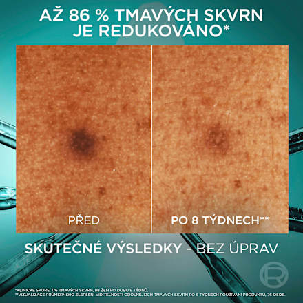 Bright Reveal pleťové sérum  L'ORÉAL PARiS