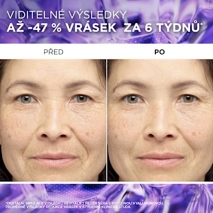Revitalift Filler hyaluronové sérum proti vráskám L'ORÉAL PARiS REVITALIFT