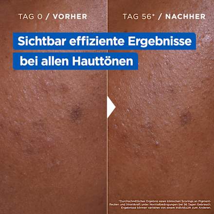 Pflegecreme Niacinamide Bright Mixa