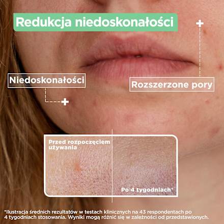 Serum przeciw niedoskonałościom Mixa