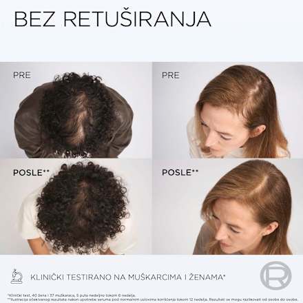GROWTH BOOSTER serum za kosu sklonu opadanju L'ORÉAL PARiS ELSEVE
