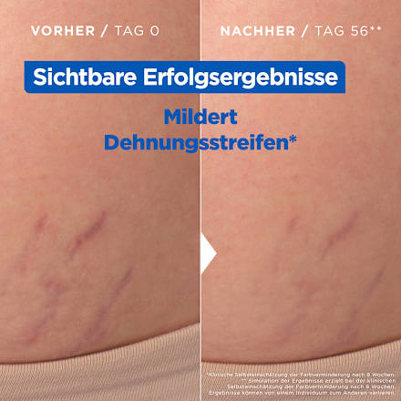 Körperöl Stretch Mark Oil Mixa