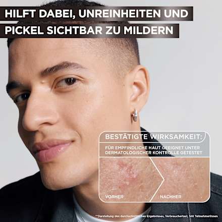 Serum Anti-Unreinheiten AHA + BHA Kohle Garnier Skin Active