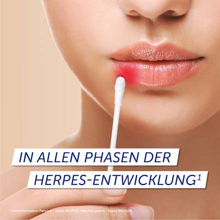 Pencivir bei Lippenherpes 10 mg/g Creme PENCIViR