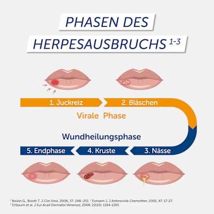 Pencivir bei Lippenherpes 10 mg/g Creme PENCIViR