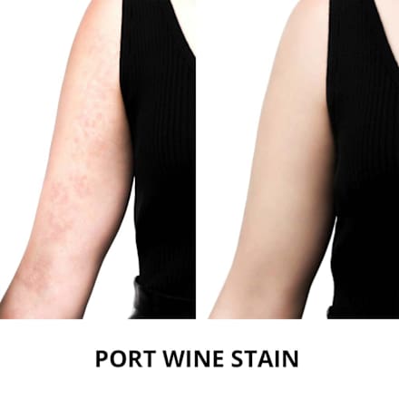 Concealer Camouflage Cream 7 Deep Whiskey ARTDECO