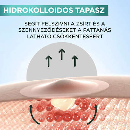 Pattanás tapasz BHA-val GARNIER PureActive