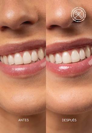 Lipgloss Clear LSF 50, regenerierend Transparent Lab