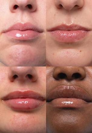 Lipgloss Clear LSF 50, regenerierend Transparent Lab