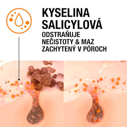 Čistiaci pleťový peeling Blackhead Eliminating s kyselinou salicylovou Neutrogena